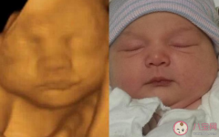 胎儿快速成长期孕妇身体变化胎儿猛长期是何