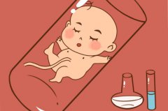 试管婴儿需要什么条件才可以做试管婴儿可以选择双胞胎吗？