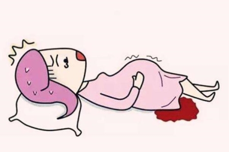 孕妇流产是什么感觉 孕妇流产要休息多久 孕妇流产是什么感觉 孕妇流产要休息多久