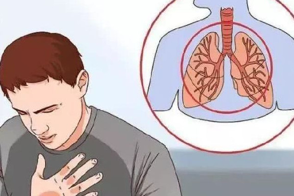 咳嗽什么样子代表要好了 咳嗽快速止咳小妙招 咳嗽什么样子代表要好了 咳嗽快速止咳小妙招