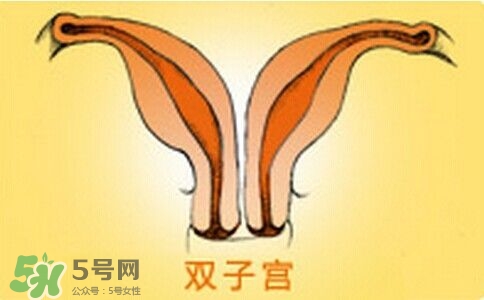双子宫是什么意思？双子宫可以顺产吗？