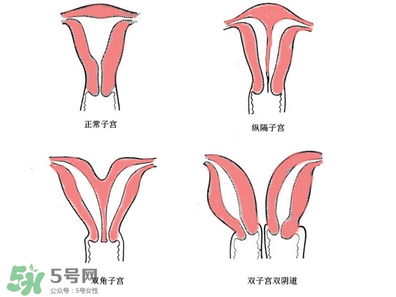 双子宫是什么意思？双子宫可以顺产吗？