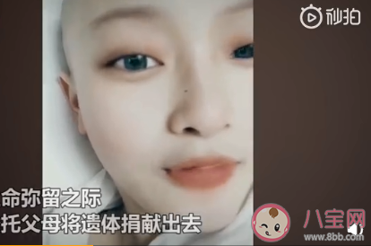 淋巴瘤是怎么产生的病因有哪些 淋巴瘤该如何防治