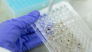 新发现924例本土重点关注变异株 该如何做措施？