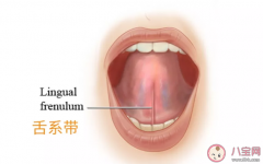 舌系带过短要不要剪 舌系带短常见手术方式